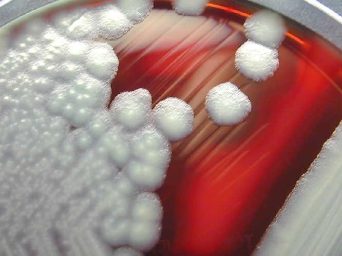 Bacillus cereus showing hemolysis on sheep blood agar. From Public Health Image Library (PHIL). [9]