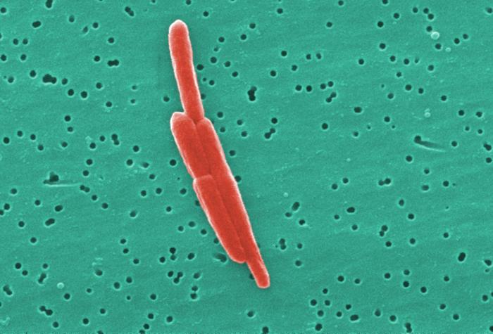 This digitally-colorized scanning electron micrograph (SEM) depicted a small grouping of Gram-negative Sebaldella termitidis bacteria.From Public Health Image Library (PHIL). [8]
