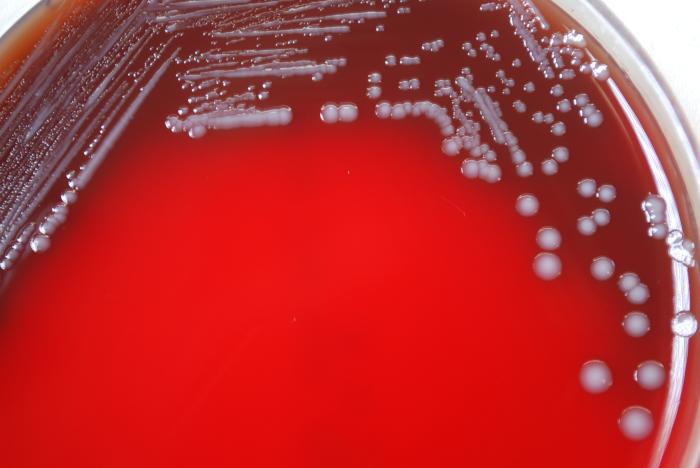 Gram-negative Yersinia pestis bacteria, which was grown on a medium of sheep’s blood agar (SBA) 72hrs. From Public Health Image Library (PHIL). [13]