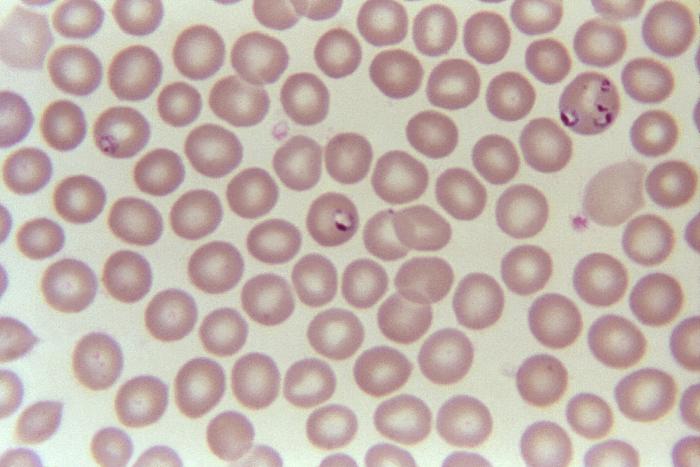 Blood smear showing large Babesia rings in erythrocytes. From Public Health Image Library (PHIL). [2]