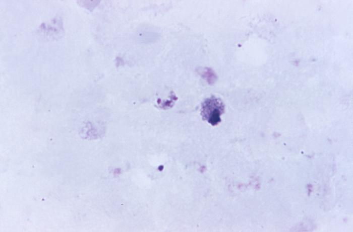 Magnified 1125X, this thick-film, Giemsa-stained photomicrograph revealed the presence of an immaturePlasmodium malariae schizont (cntr), which is situated to the left of an eosinophile. Adapted from Public Health Image Library (PHIL), Centers for Disease Control and Prevention.[6]