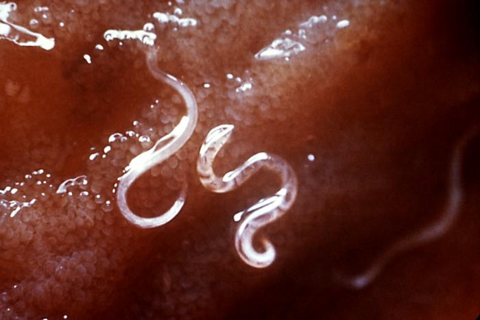 This enlargement shows hookworms, Ancylostoma caninum attached to the intestinal mucosa. From Public Health Image Library (PHIL). [1]