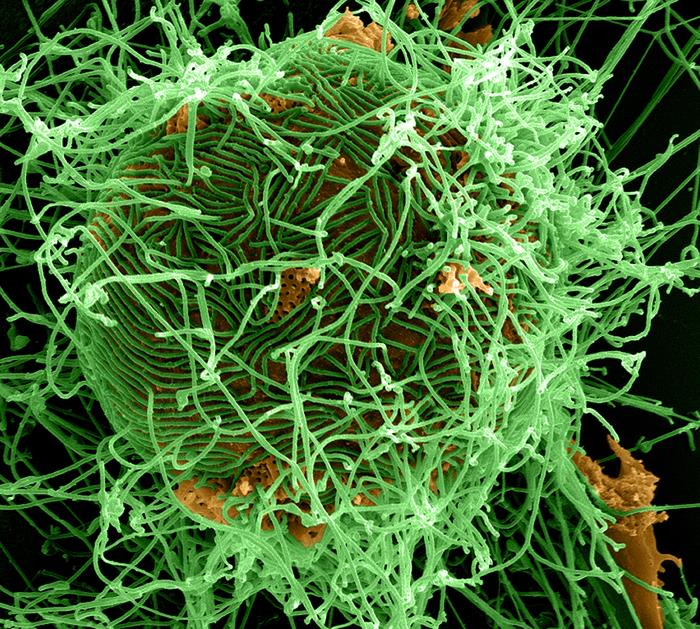 Produced by the National Institute of Allergy and Infectious Diseases (NIAID), under a magnification of 25,000X, this digitally-colorized scanning electron micrograph (SEM) depicts numerous filamentous Ebola virus particles (green) budding from a chronically-infected VERO E6 cell (orange). From Public Health Image Library (PHIL). [8]