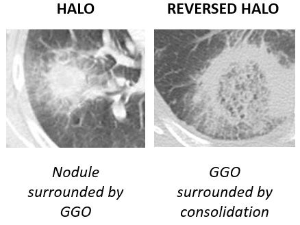 File:Halo and reversed halo.jpg