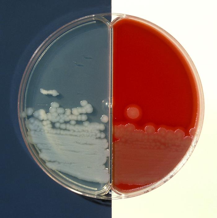 Blood agar and bicarbonate agar plate cultures of Bacillus cereus. From Public Health Image Library (PHIL). [9]