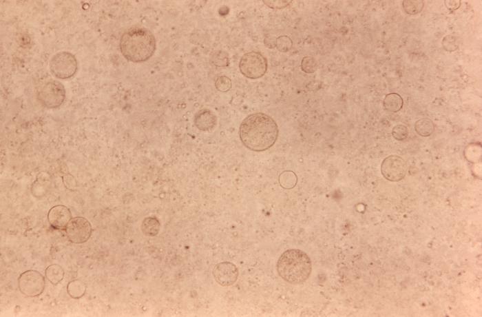 Photomicrograph of of pus from a Guinea pig, Cavia porcellus, reveals presence of numbers of Coccidioides sp. fungal sporangia. From Public Health Image Library (PHIL). [5]