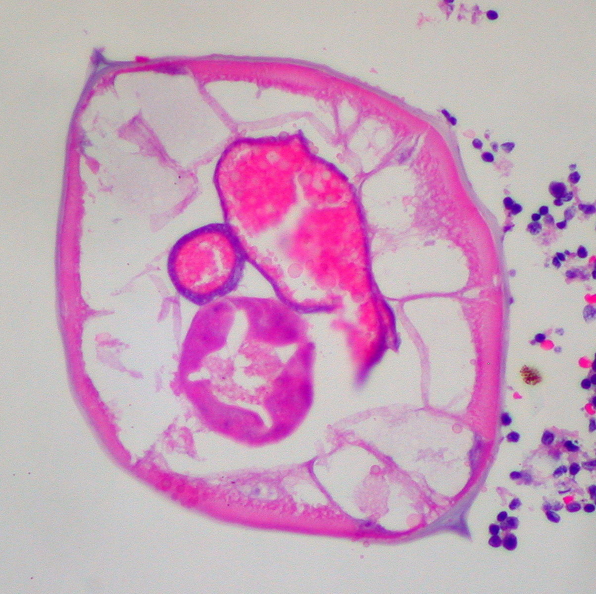 High magnification micrograph of a pinworm in cross-section in the appendix. H&E stain.