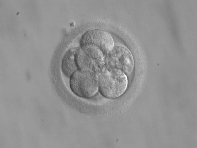 Morula, 8 cell stage