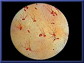 Salmonella typhi.jpg