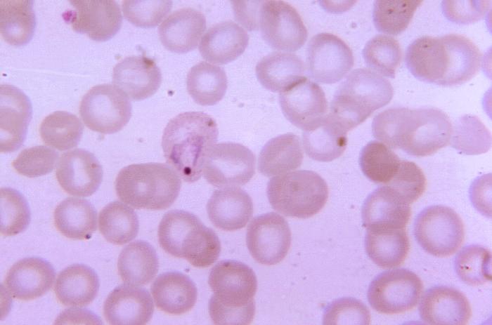 Magnified 1125X, this thin film photomicrograph of a blood smear, revealed the presence of a young growing Plasmodium vivax amoeboid trophozoite Adapted from Public Health Image Library (PHIL), Centers for Disease Control and Prevention.[6]