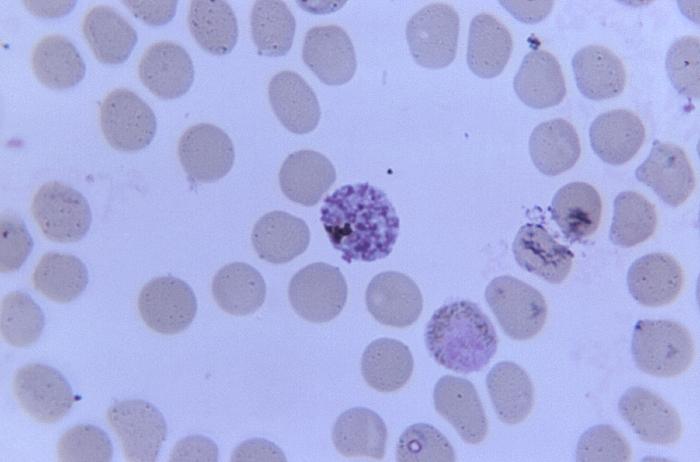 Magnification of 1125X, this photomicrograph of a simian blood sample revealed the presence of a mature simian malarial schizont and gametocyte Adapted from Public Health Image Library (PHIL), Centers for Disease Control and Prevention.[6]