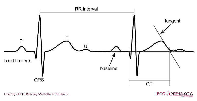 Calculation of the corrected QT interval using the tangent method
