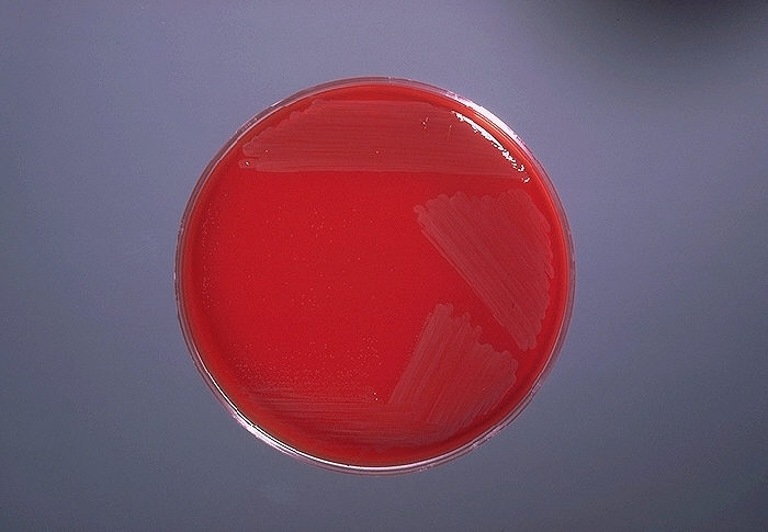 Blood agar plate culture of Campylobacter fetus s. intestinalis. From Public Health Image Library (PHIL). [1]