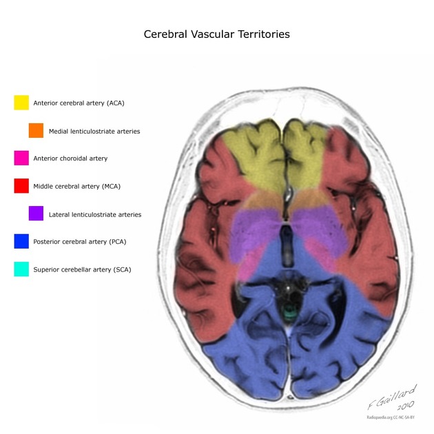 File:Cerebral vascular territories.jpeg