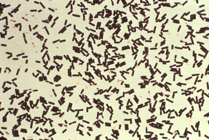 Photomicrograph of Clostridium perfringens bacteria that had been grown in Schaedler’s broth, and subsequently stained using Gram-stain (1000X mag). From Public Health Image Library (PHIL). [5]
