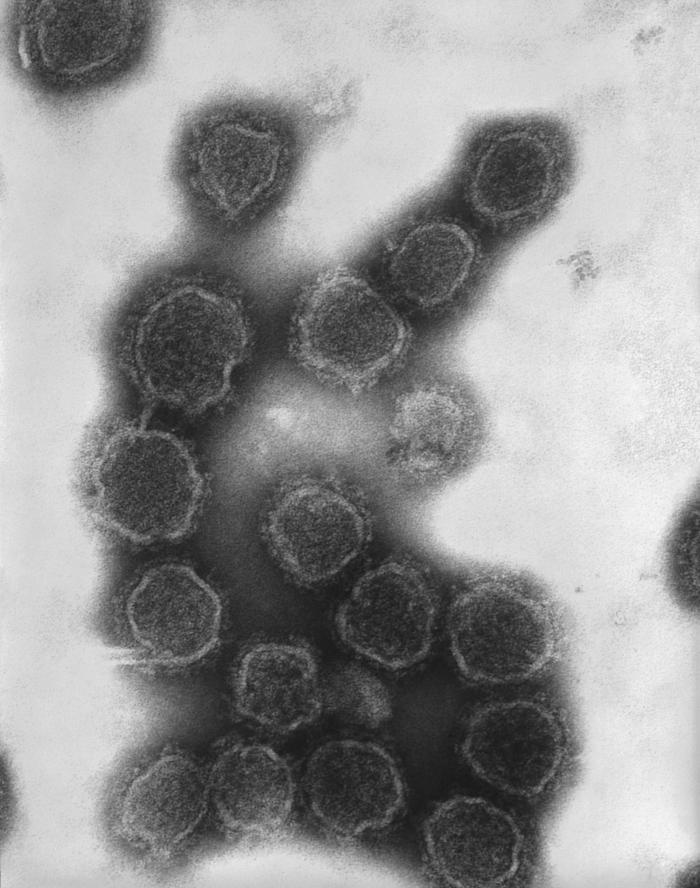 This negatively-stained transmission electron micrograph (TEM) revealed the presence of numerous California encephalitis virus virions. Contained within its enveloped capsid, the genome of this Bunyaviridae family member consists of three segments of negative-sense single-stranded RNA ((-)ssRNA). From Public Health Image Library (PHIL). [1]