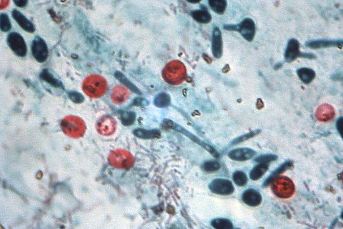 Micrograph of a direct fecal smear is stained to detect Cryptosporidium sp., an intracellular protozoan parasite. From Public Health Image Library (PHIL). [1]