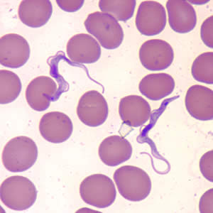Trypanosoma brucei ssp. in a thin blood smear stained with Giemsa. The trypomastigote is beginning to divide; dividing forms are seen in African trypanosomes, but not in American trypanosomes. Adapted from CDC