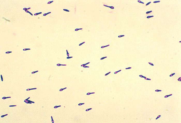 Photomicrograph of Clostridium botulinum type A. From Public Health Image Library (PHIL). [34]
