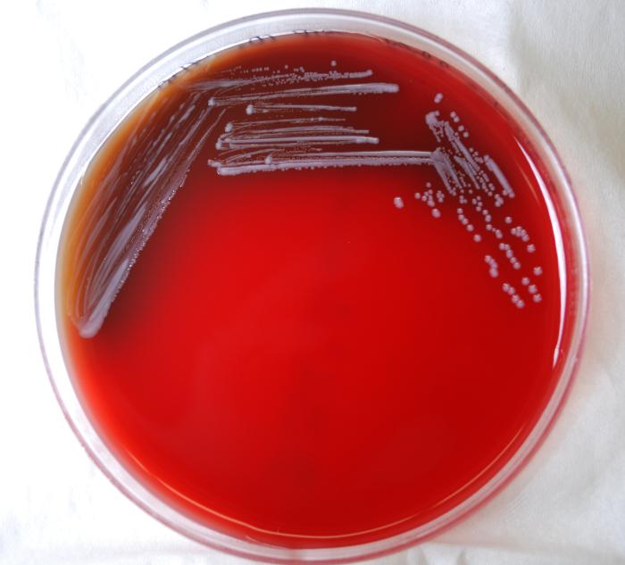 Brucella abortus bacteria grown on a medium of sheep’s blood agar (SBA) 72hrs. From Public Health Image Library (PHIL). [18]