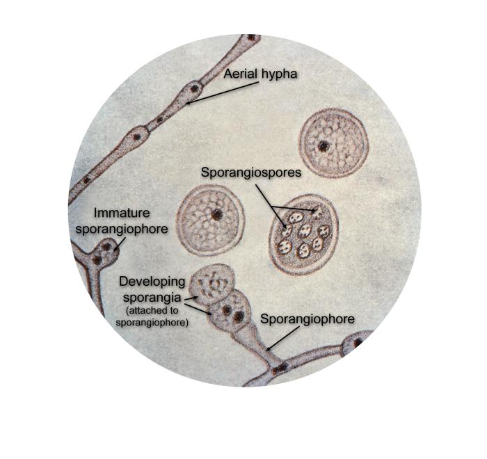 Ultrastructural details of Blastomyces dermatitidis including the organism’s aerial hypha, developing sporangia. From Public Health Image Library (PHIL). [1]