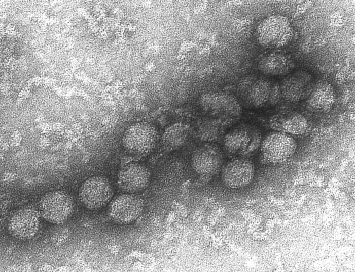 This is a transmission electron micrograph (TEM) of the West Nile virus (WNV). From Public Health Image Library (PHIL). [14]