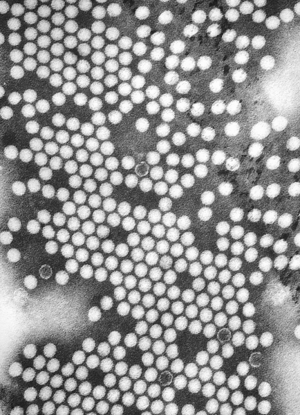 TEM micrograph of Poliovirus virions.