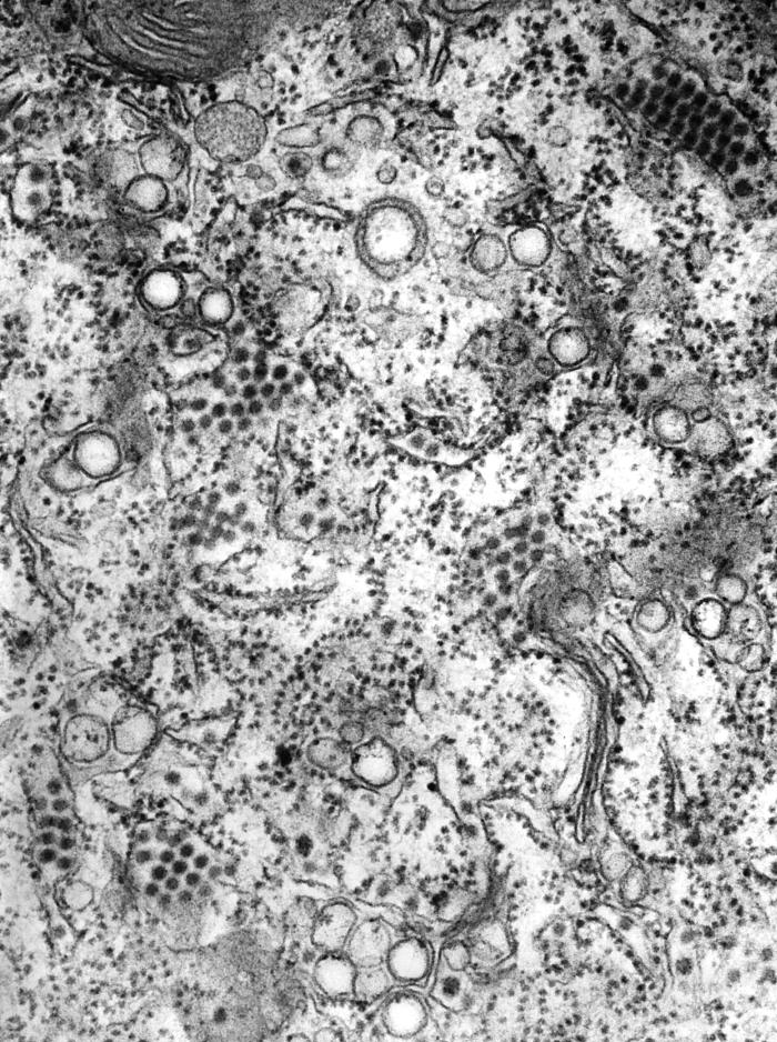 Transmission electron micrograph (TEM) reveals the presence of numerous St. Louis encephalitis (SLE) virions that were contained inside a central nervous system tissue sample. From Public Health Image Library (PHIL). [2]