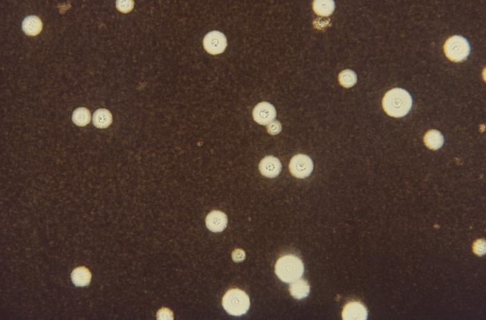 Photomicrograph revealed some of the ultrastructural details displayed by numerous Cryptococcus neoformans fungal organisms (475x mag). From Public Health Image Library (PHIL). [1]