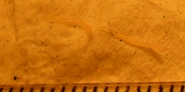 Two pinworms, captured on emergence from the anus. Markings are 1 mm apart.