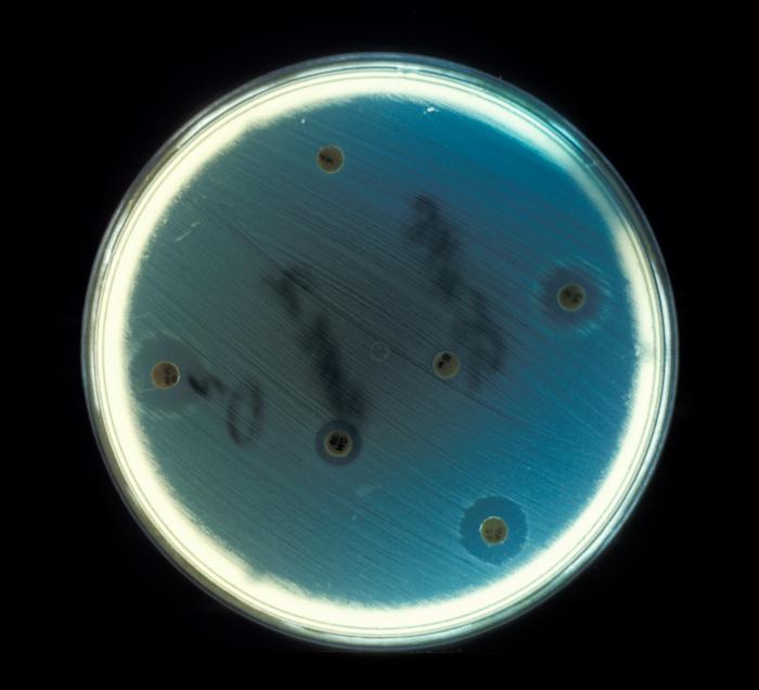 Enterococcus faecalis cultured on an agar plate, testing for drug sensitivity in an anaerobic environment. From Public Health Image Library (PHIL). [9]