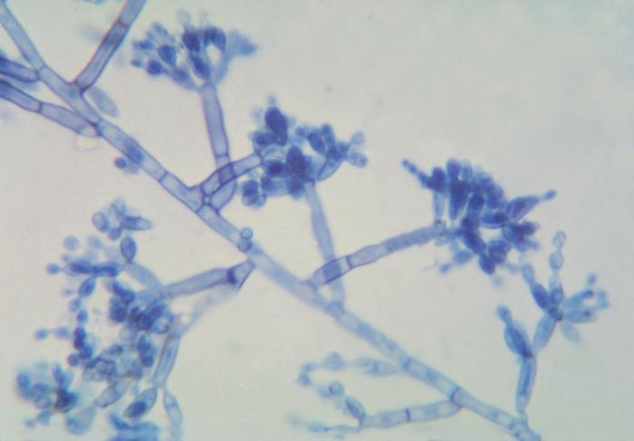 Photomicrograph of the dematiaceous, or dark colored fungi Fonsecaea pedrosoi. From Public Health Image Library (PHIL). [2]