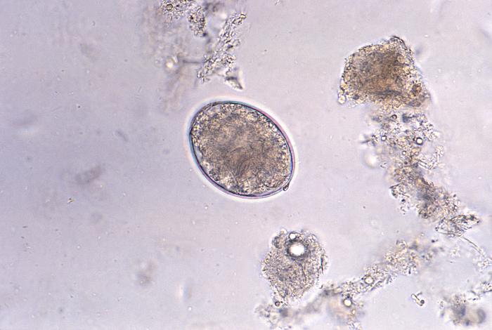 Photomicrograph reveals the presence of a cestode, Diphyllobothrium latum, or “broad” tapeworm, egg, which is described as oval or ellipsoidal, and range in size from 55µm to 75µm by 40µm to 50µm (400X mag). From Public Health Image Library (PHIL). [1]