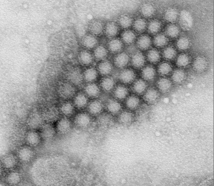 Transmission electron micrograph (TEM) revealed some of the ultrastructural morphology displayed by Norovirus virions. From Public Health Image Library (PHIL). [41]