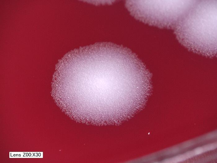Bacillus anthracis. From Public Health Image Library (PHIL). [1]