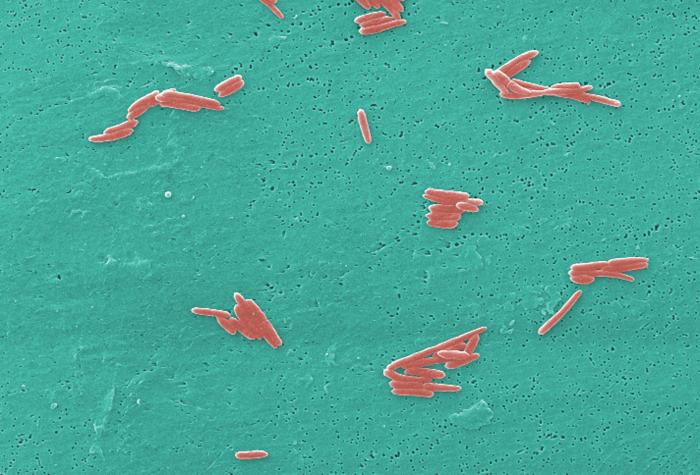 This digitally-colorized scanning electron micrograph (SEM) depicted numbers of Gram-negative Sebaldella termitidis bacteria. From Public Health Image Library (PHIL). [7]
