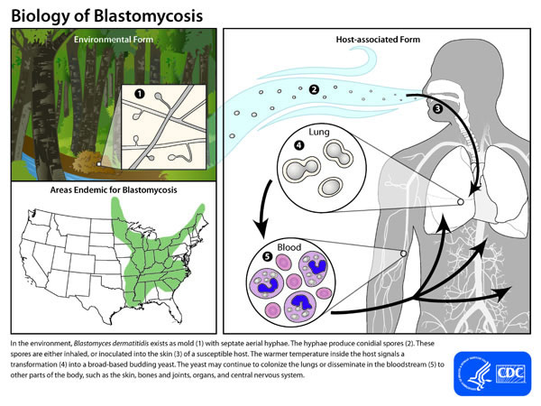 File:Blastomycosis-lifecycle.jpg