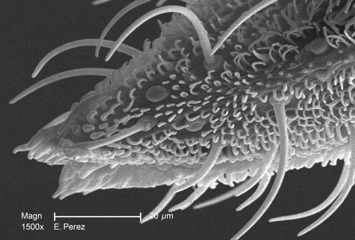 Magnified 1500X, this scanning electron micrograph (SEM) revealed some of the minute exoskeletal details found at the proboscis tip of an unidentified mosquito found deceased in the suburbs of Decatur, Georgia. The proboscis is the organ used by this, as well as other like insects, to feed upon the blood of a warm-blooded host, including human beings. From Public Health Image Library (PHIL). [21]