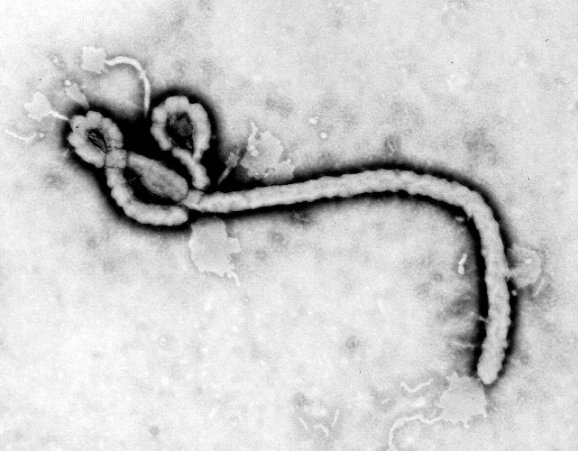 This transmission electron micrograph (TEM) demonstrates the ultrastructural morphology displayed by an Ebola virus. Source: CDC microbiologist Frederick A. Murphy,.