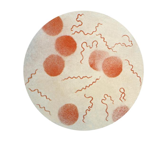 Illustration depicts a photomicrographic view of a culture specimen revealing the presence of numerous Borrelia recurrentis bacteria, which cause European relapsing fever. This bacterium is transmitted from person-to-person by way of the human body louse, Pediculus humanus var. corporis. From Public Health Image Library (PHIL). [1]