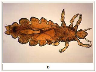 Adult female louse