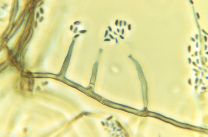Photomicrograph reveals morphologic details displayed by the fungal organism, Phialophora parasitica, which is known to be a cause of chromoblastomycosis (1125x mag). From Public Health Image Library (PHIL). [2]