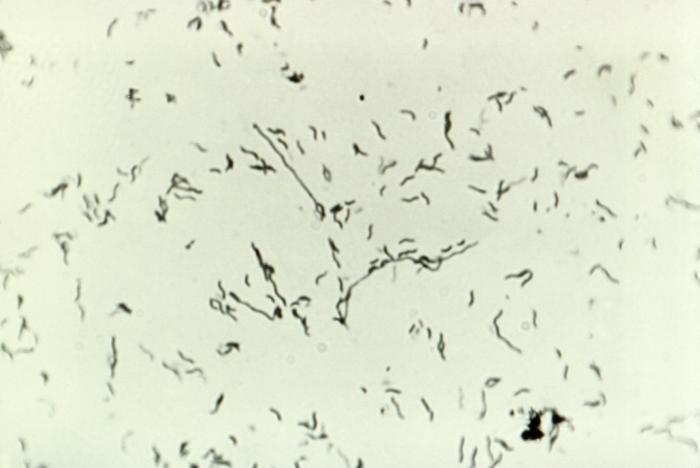 File:Campylobacter04.jpeg