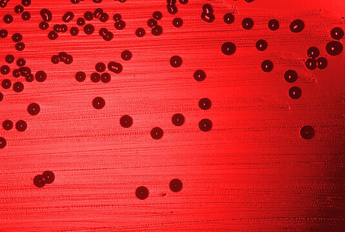 Blood agar plate culture of Haemophilus influenzae. From Public Health Image Library (PHIL). [2]