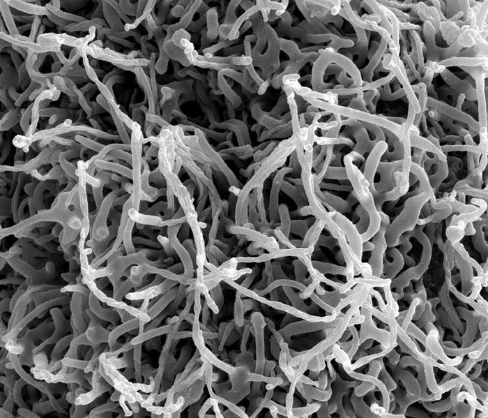 Produced by the National Institute of Allergy and Infectious Diseases (NIAID), under a magnification of 50,000X, this scanning electron micrograph (SEM) depicts numerous filamentous Ebola virus particles replicating from an infected VERO E6 cell. From Public Health Image Library (PHIL). [8]