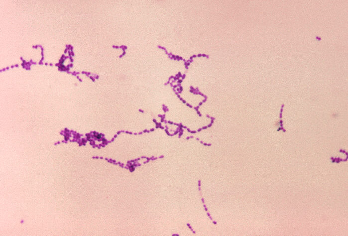Photomicrograph of Streptococcus spp. bacteria using Gram stain technique. From Public Health Image Library (PHIL). [10]