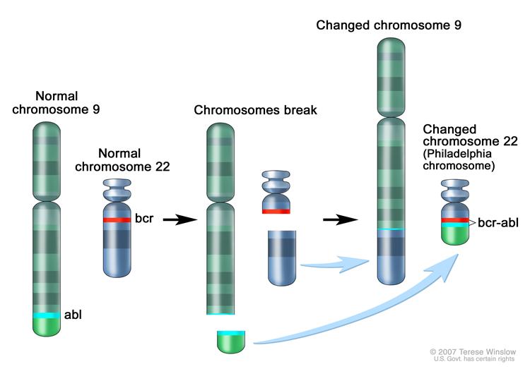 Philadelphia chromosome.jpg