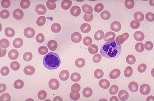 Normal peripheral blood cells