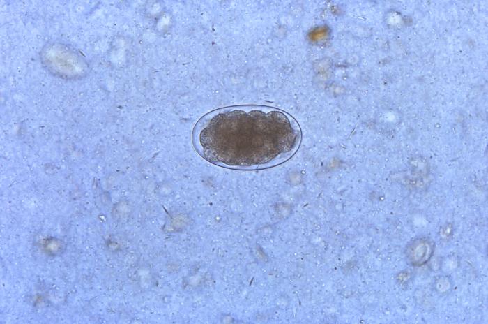 Hookworm egg undergoing the process of cellular division. From Public Health Image Library (PHIL). [3]