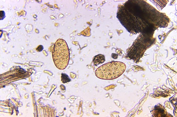 Two Fasciolopsis buski trematode eggs that were found in an unstained formalin-preserved stool sample (125X mag). From Public Health Image Library (PHIL). [4]